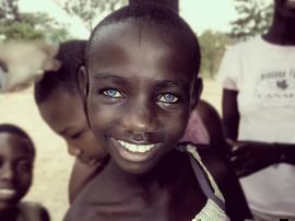 VIH/SIDA y personas sordas, Burundi